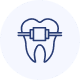 ortodoncia-interceptiva