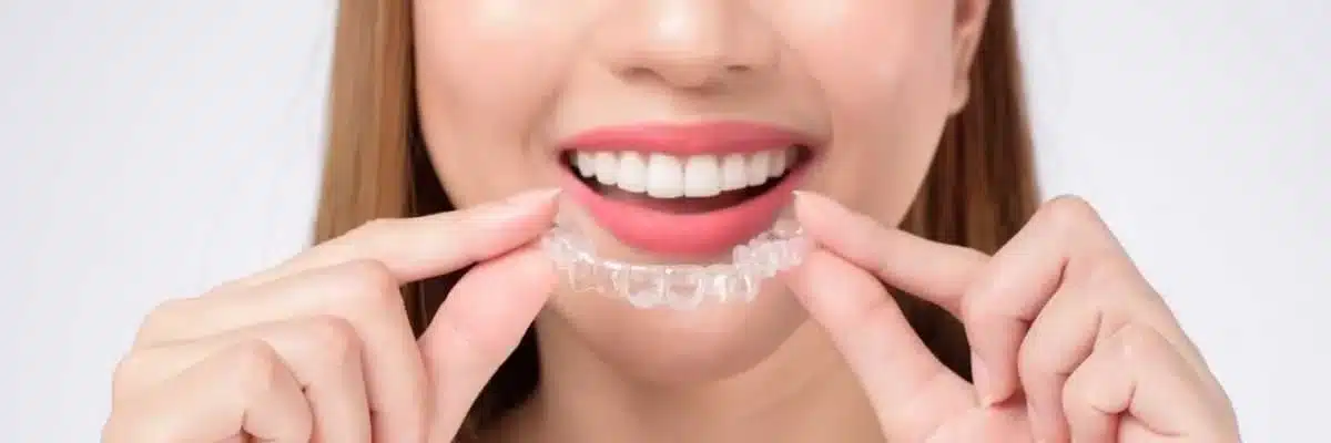 ortodoncia-invi-9-e_Xs3O