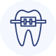 ortodoncia-metálica