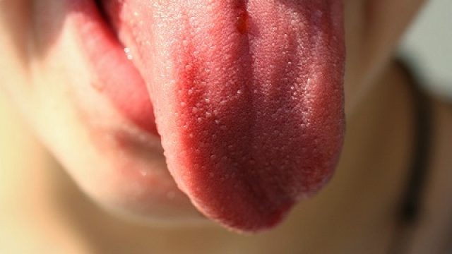 Enfermedades de la lengua